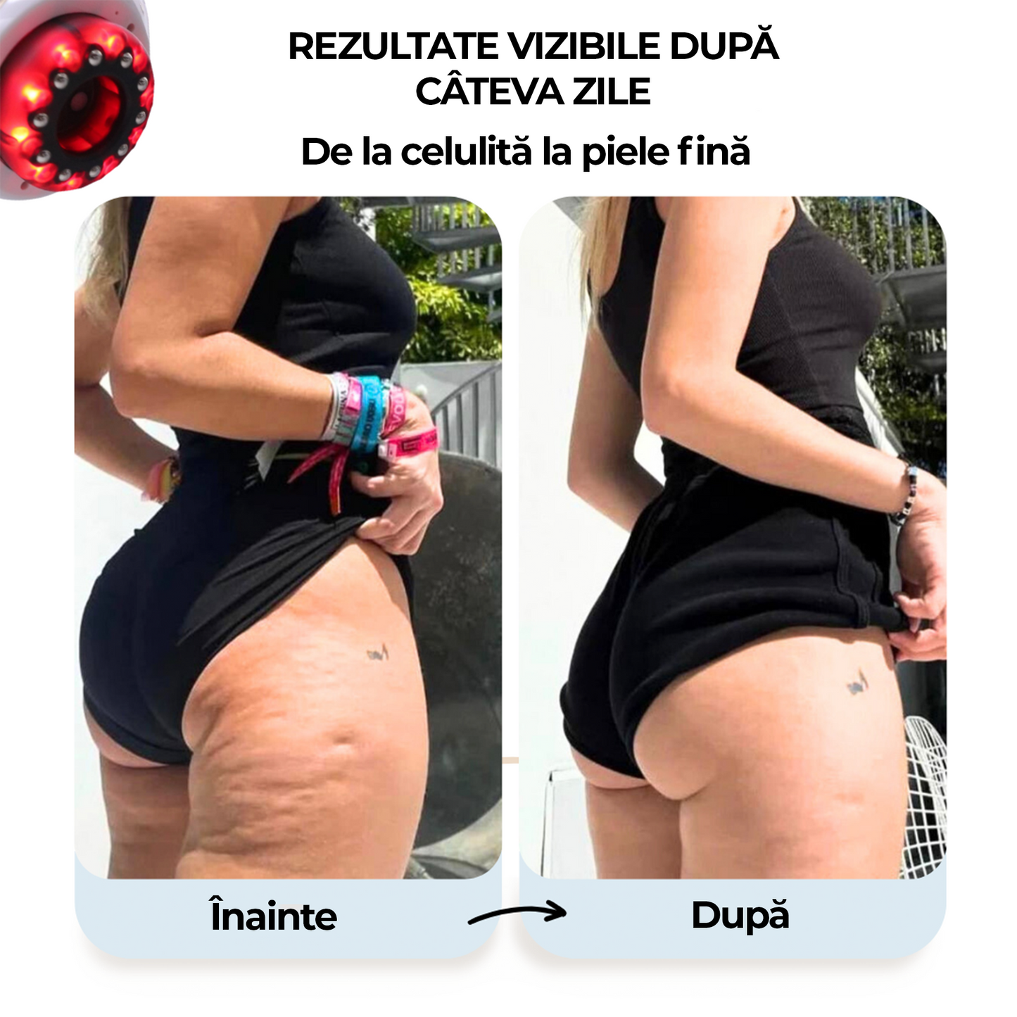 Aparat de masaj anti-celulită cu vacuum