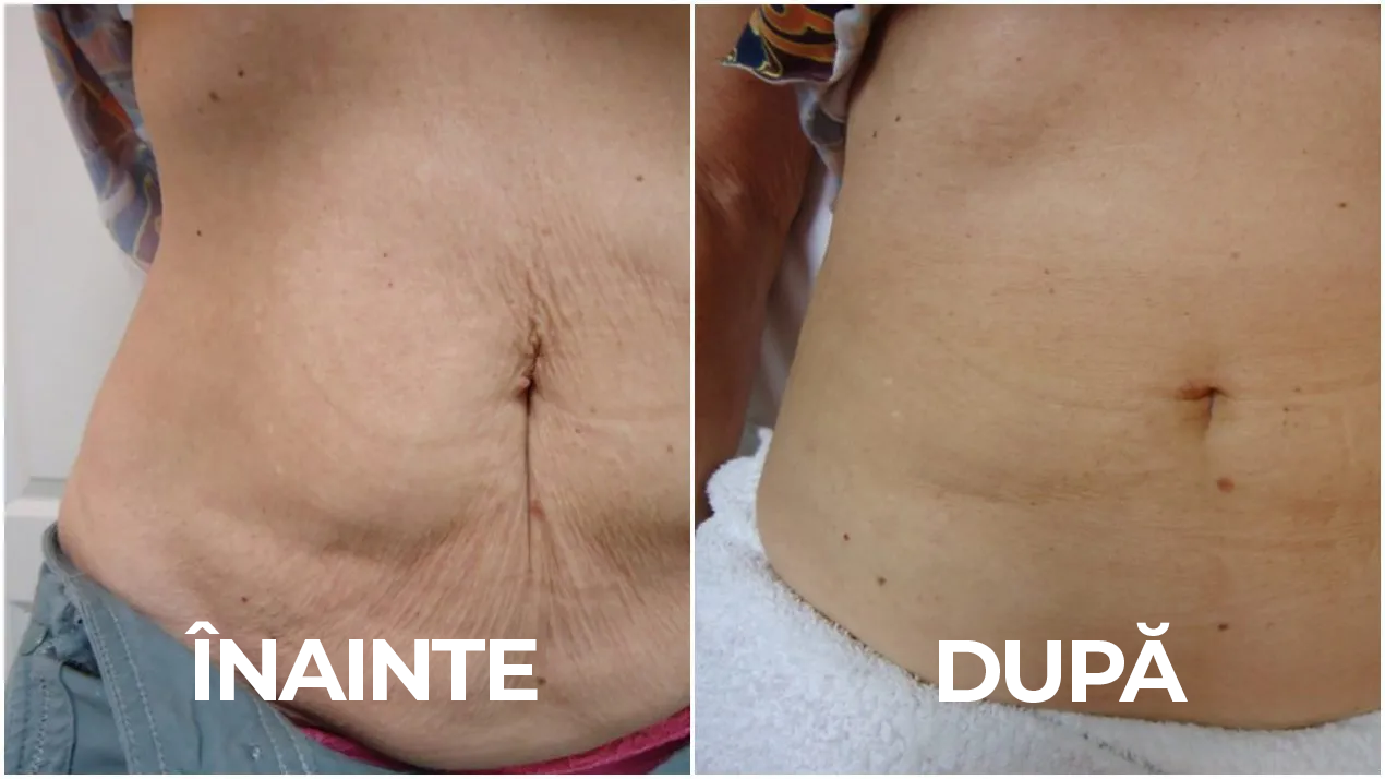 Cremă  braziliană remodelatoare 3 în 1